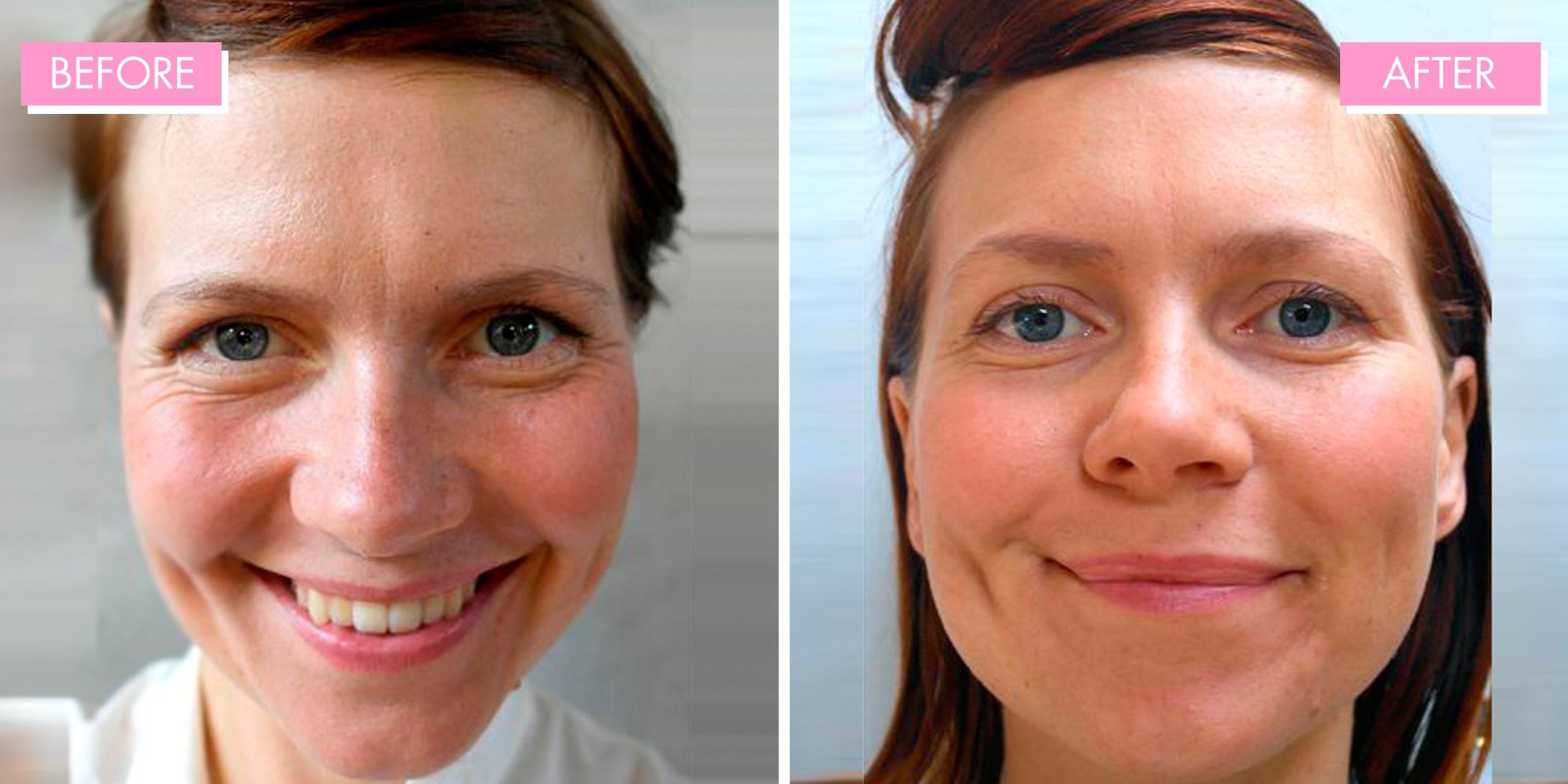 How Drinking Water Transforms Your Skin